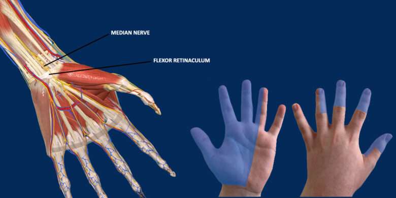 Median nerve injury, causes, symptoms, diagnosis and treatment